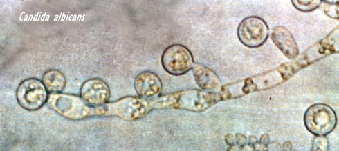 candida-albicans-pic.jpg