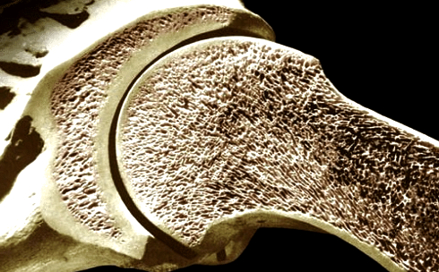 human-bone-tissue.jpg