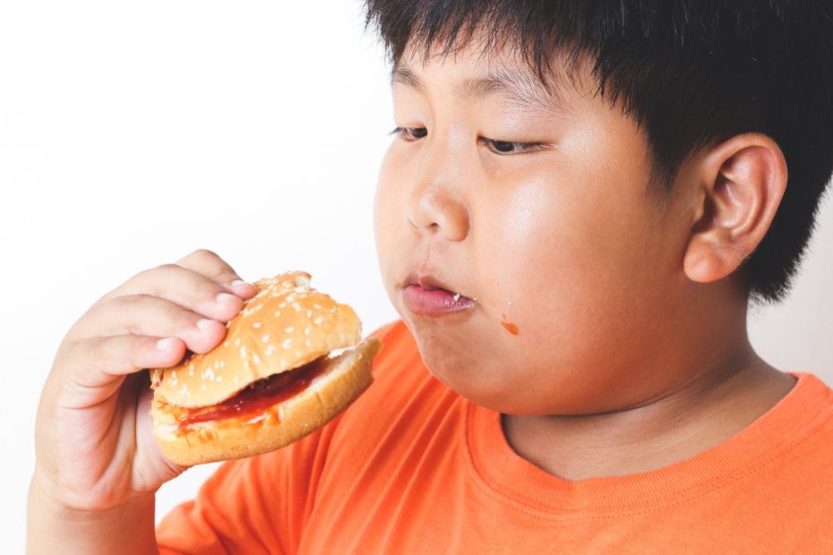 Childhood-Obesity