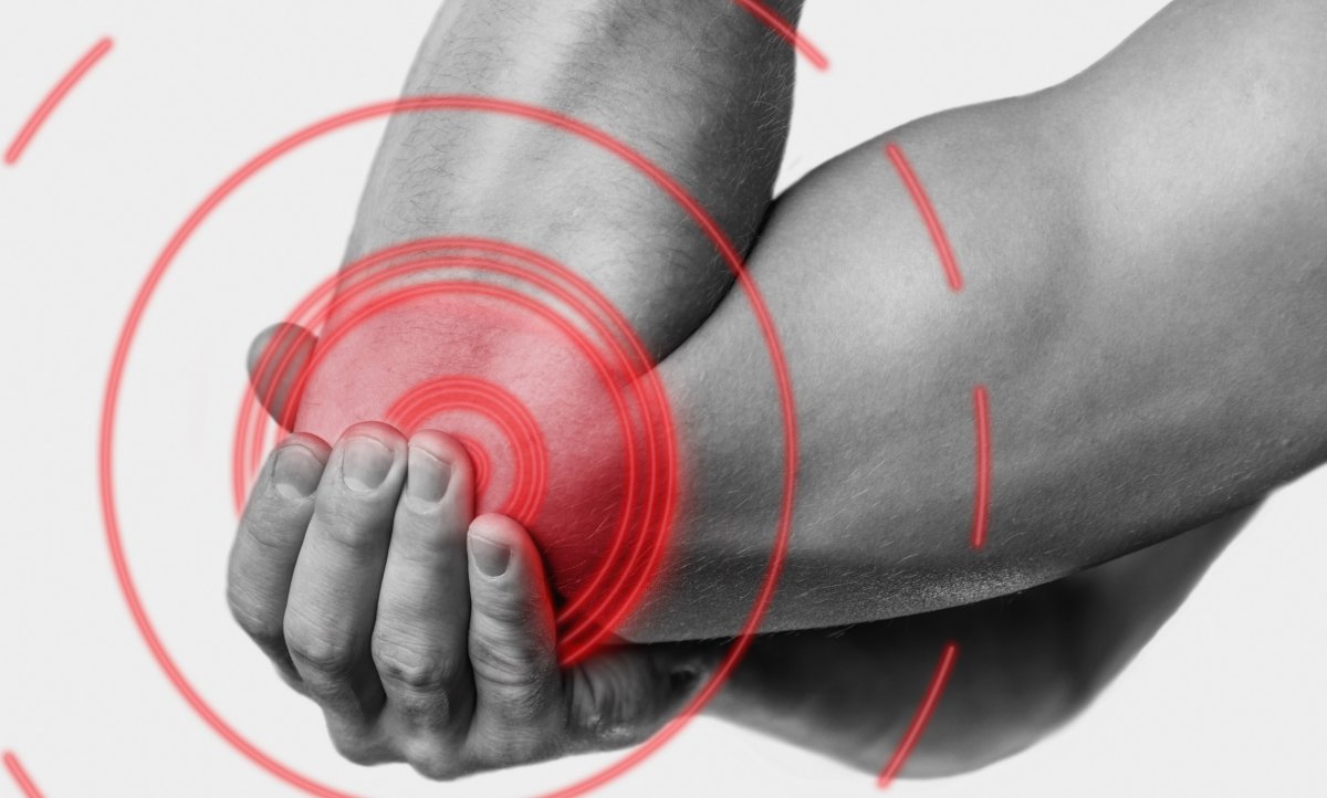 Cubital-Tunnel-Syndrome