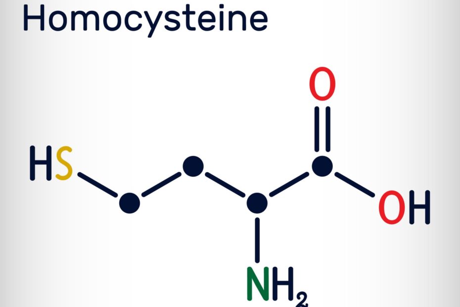 Homocysteine-Levels